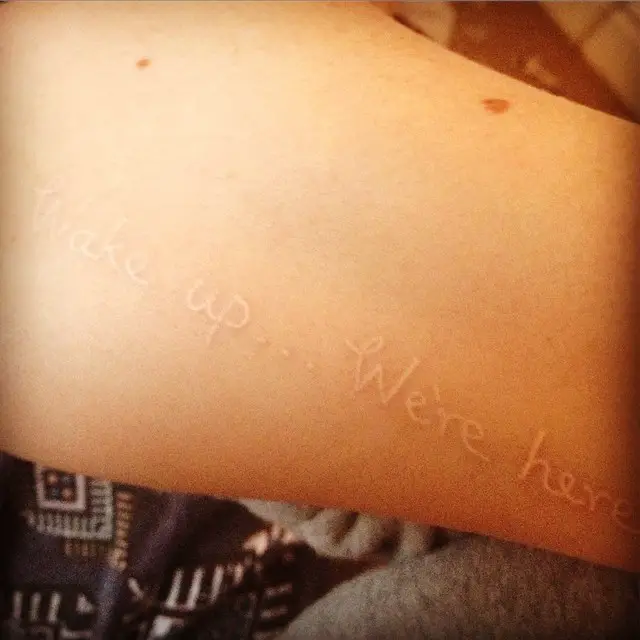 White ink tattoo on side arm