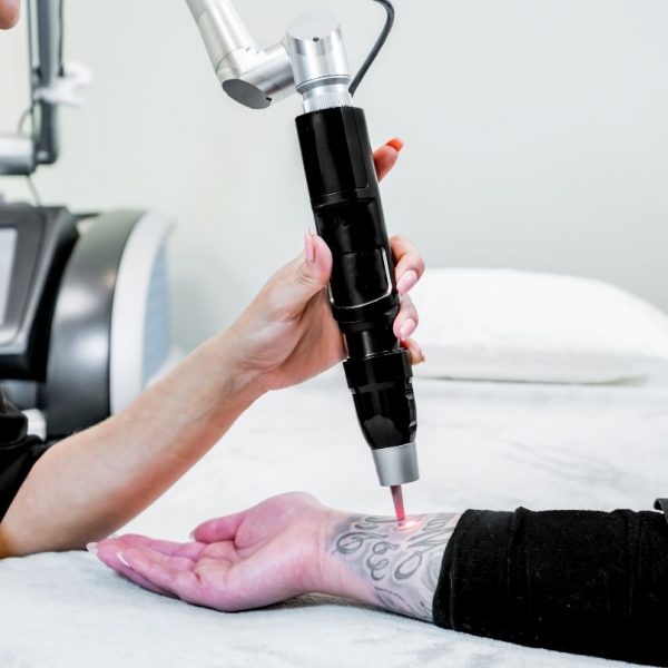 Best Lasers for Tattoo Removal: Reviews and Buying Guide 2022